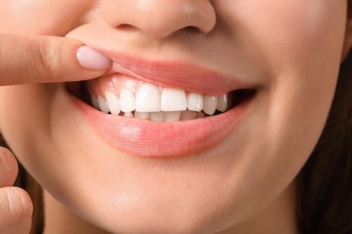 Dental Care